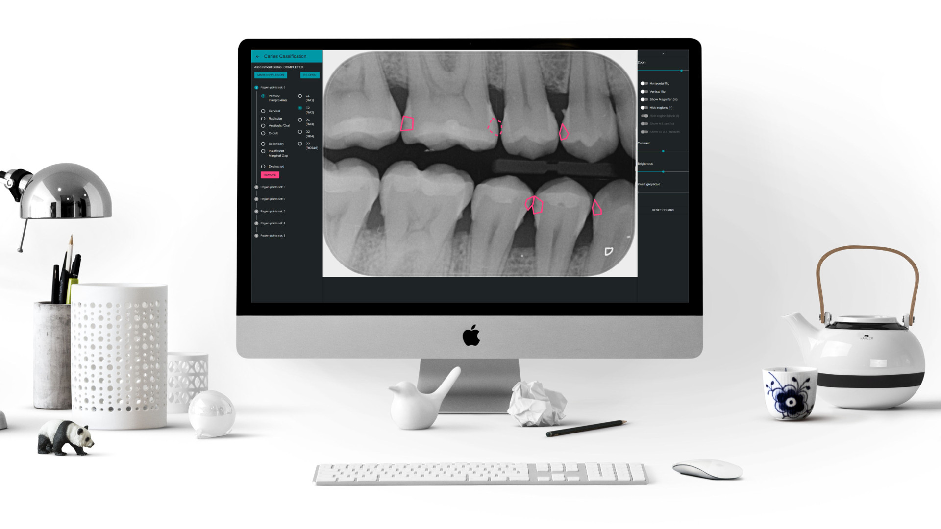 DentaliQ caries