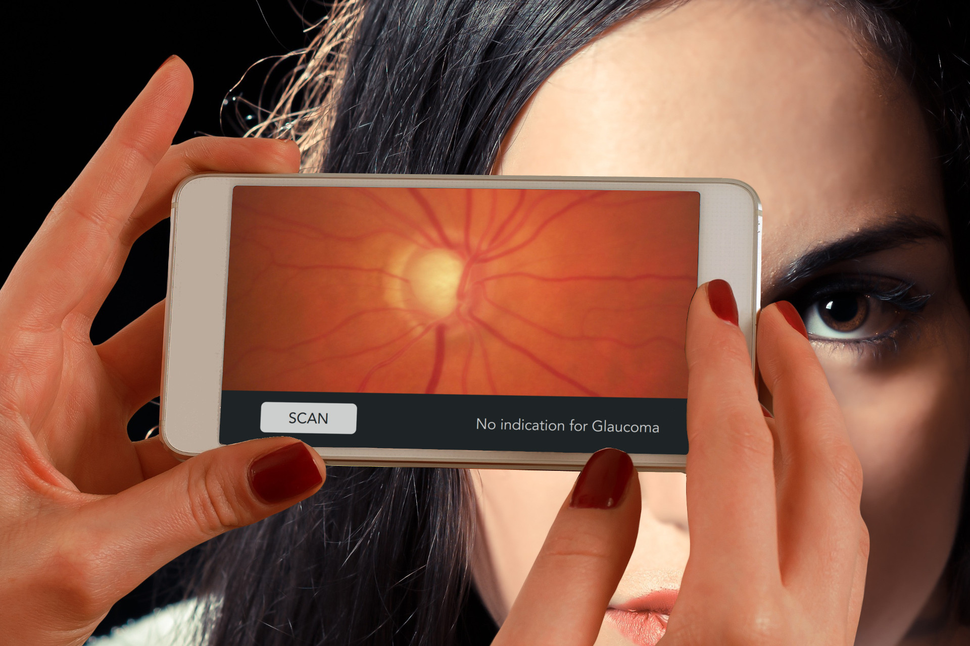 OptaliQ glauco
